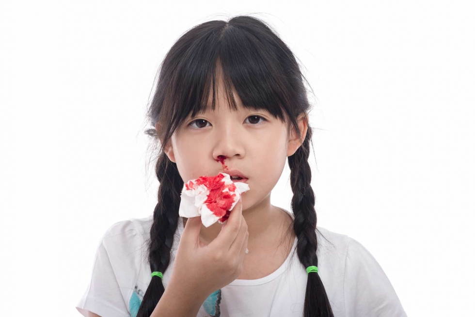 Chảy máu cam là hiện tượng máu chảy ra từ đường mũi do một số tác động gây ra
